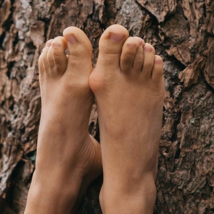 Wat is een hallux valgus?